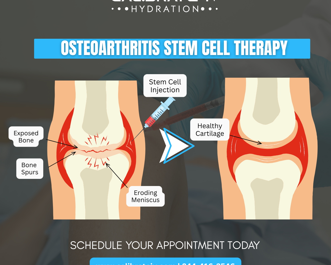 Regenerating Joint Health: How Stem Cell Therapy Supports Osteoarthritis Relief