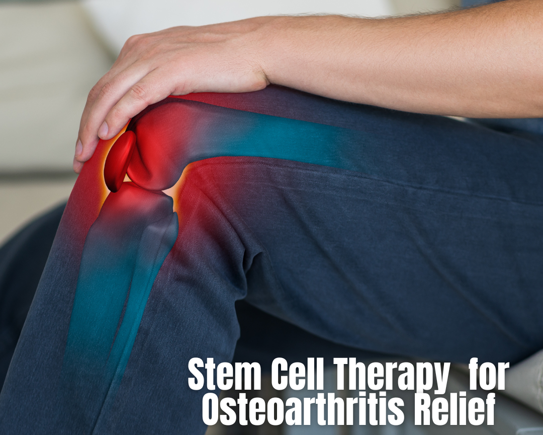 How Stem Cell Therapy is Changing the Game for Osteoarthritis Relief